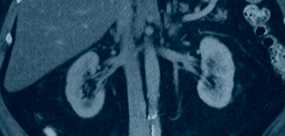 kidney x-ray film